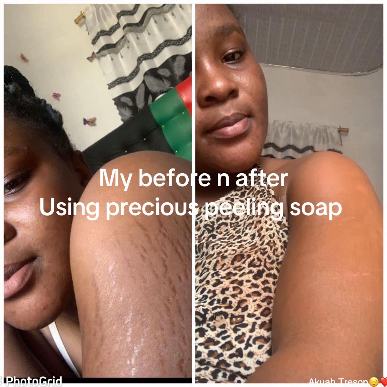 @@ Precious peeling soap