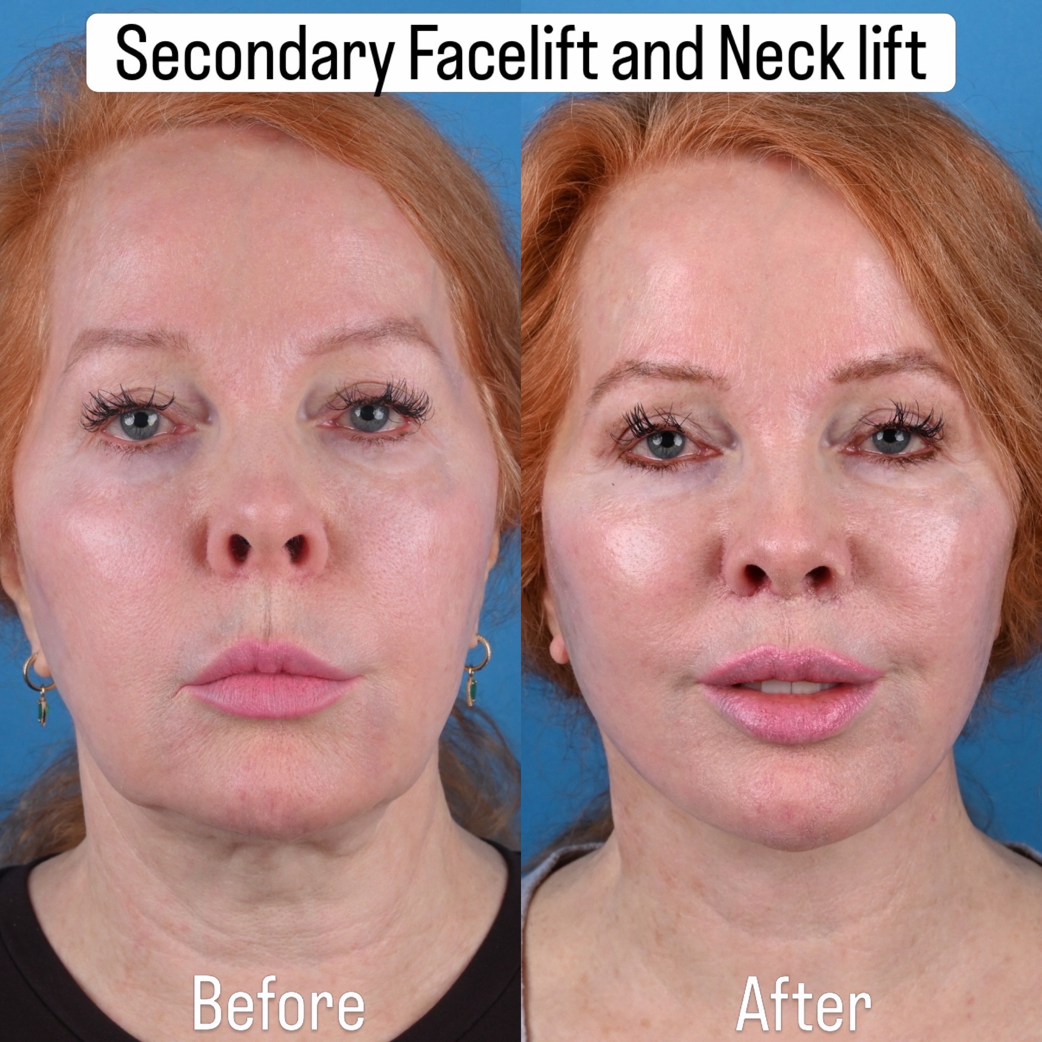 @Dr. Parit Patel, MD
