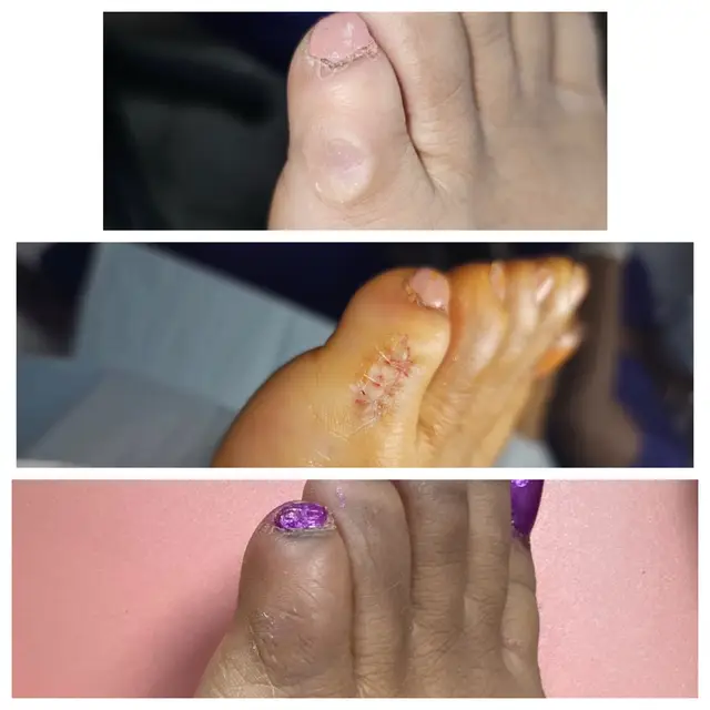 @Deniel Foot and Ankle Center