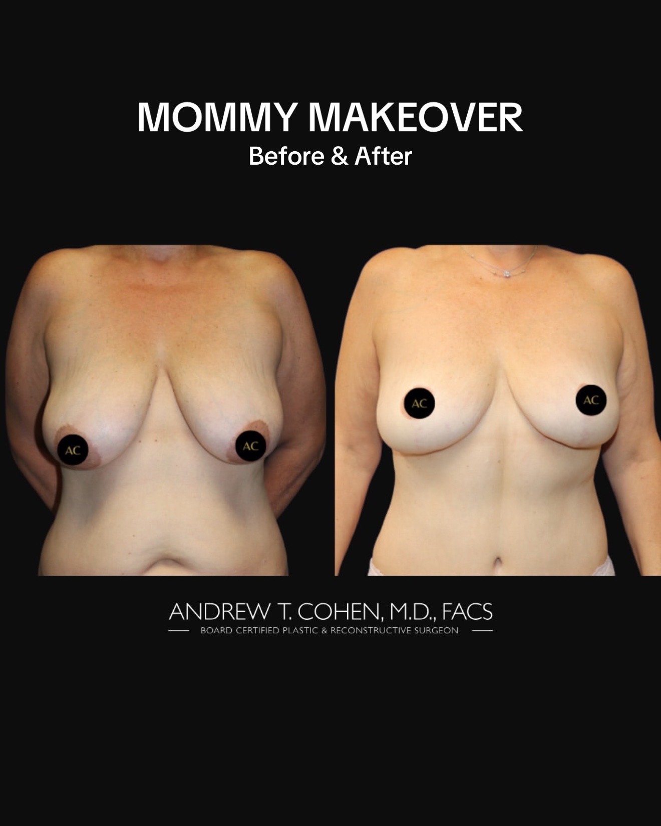 @Cohen MD Plastic Surgery