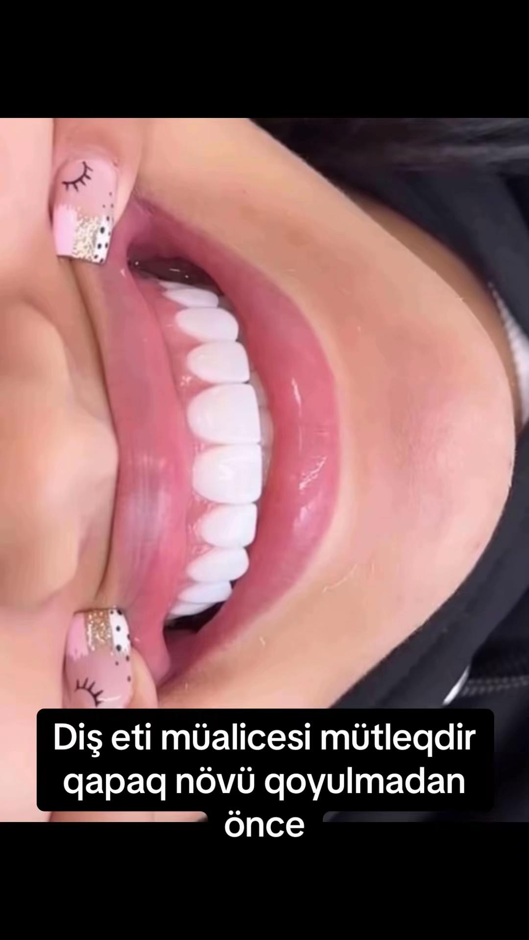 @Dentist_Günel