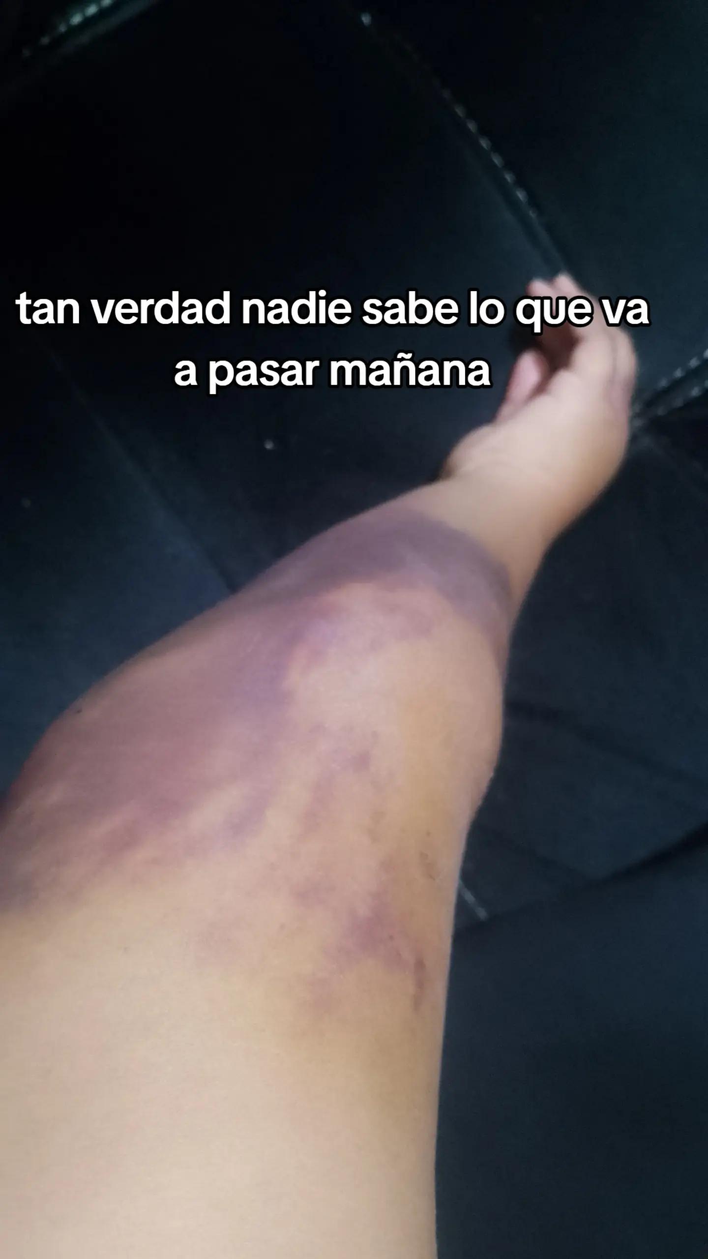 @Annie Rey