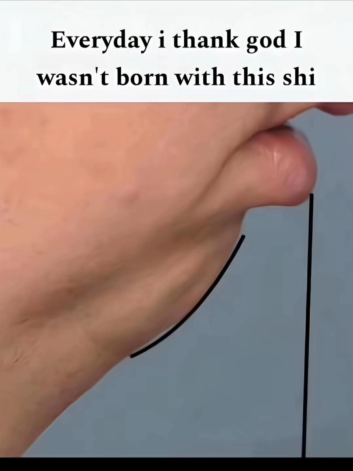 @AD