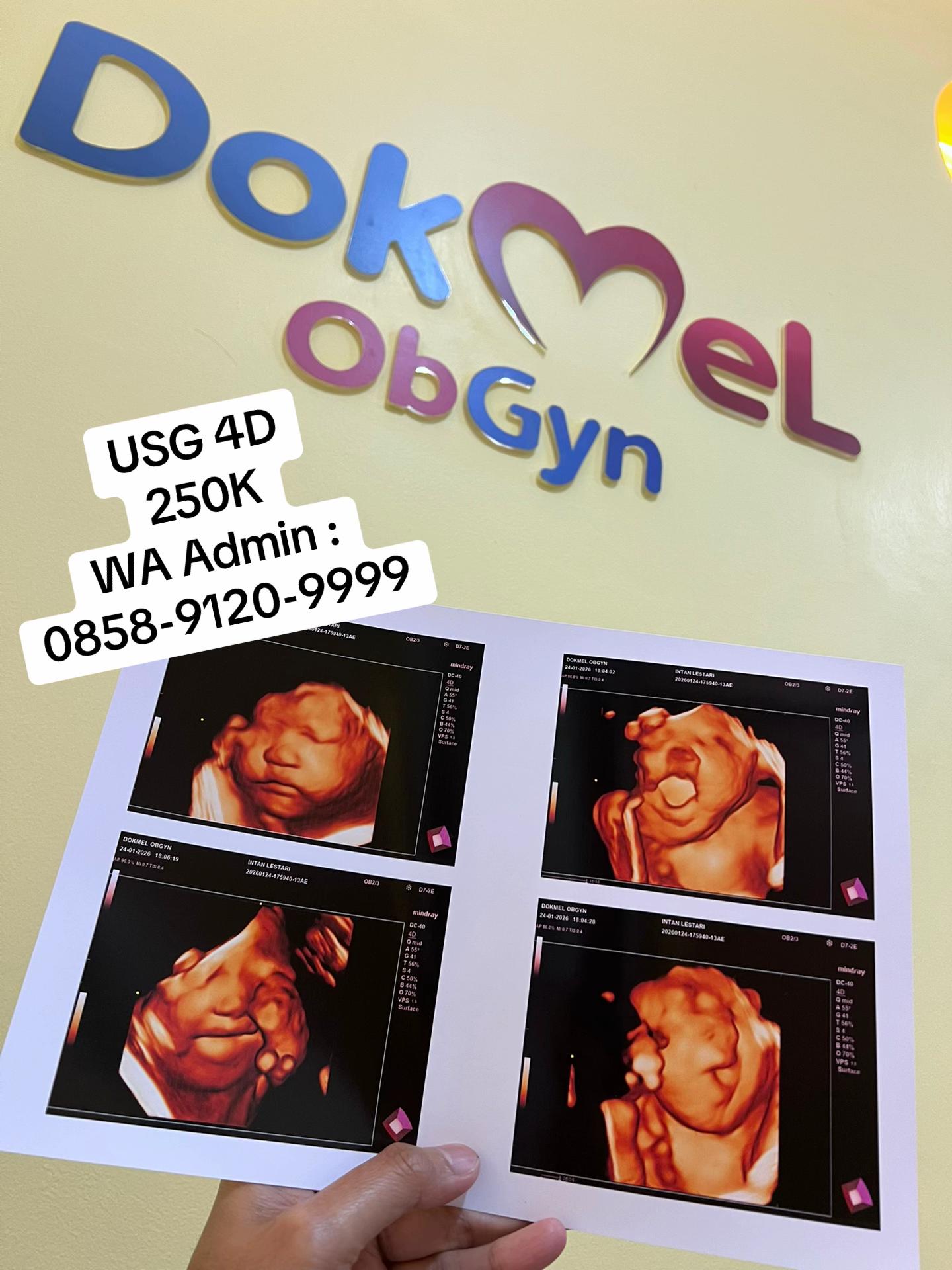 @DokMeL ObGyn
