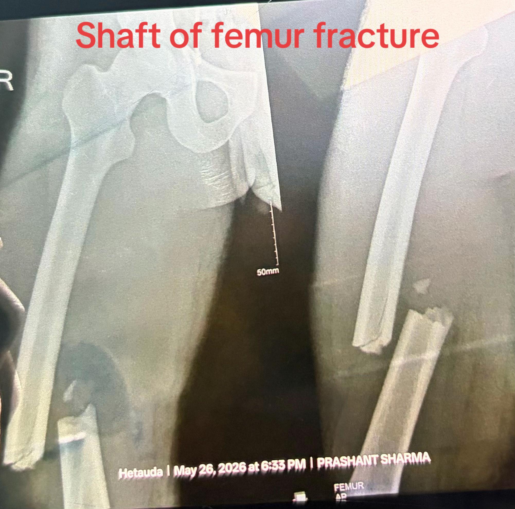 @Spine_Ortho_Surgeon_Arbind