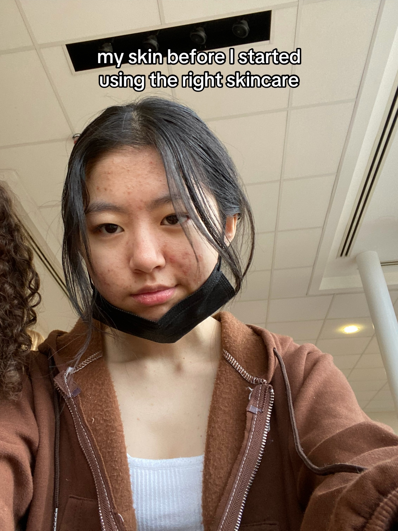 @Lily