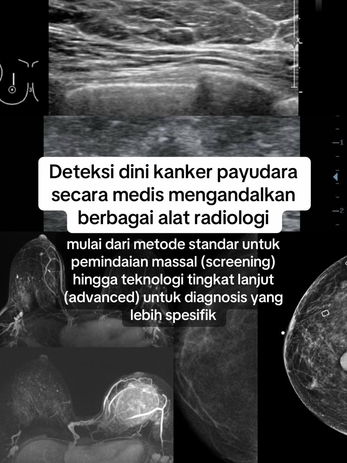 @Sobat Radiology