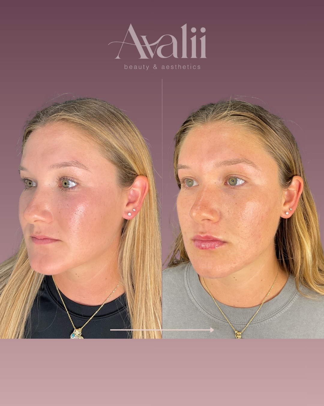 @Avalii Aesthetics