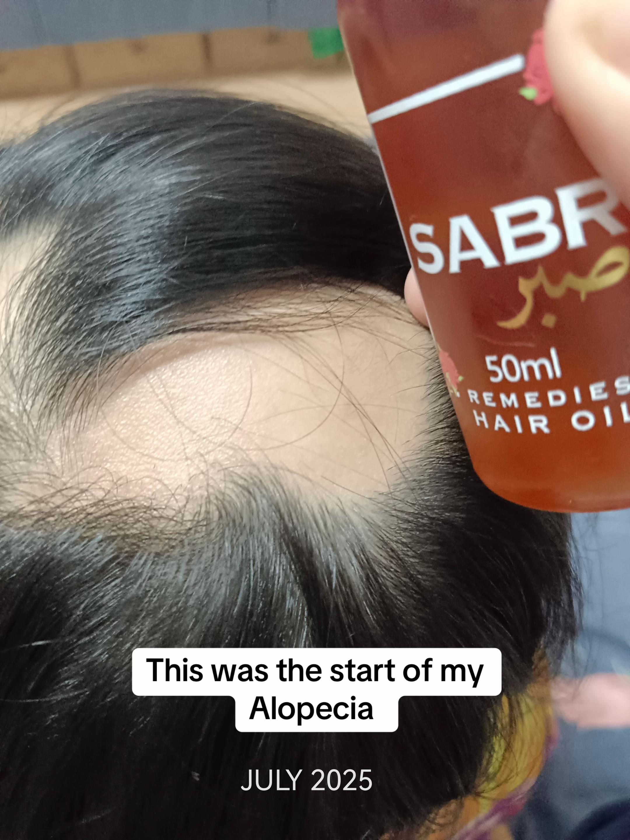 @SABR REMEDIES