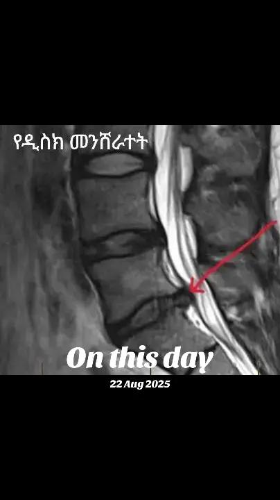 @Dr Wubie Endalew(Radiologist)