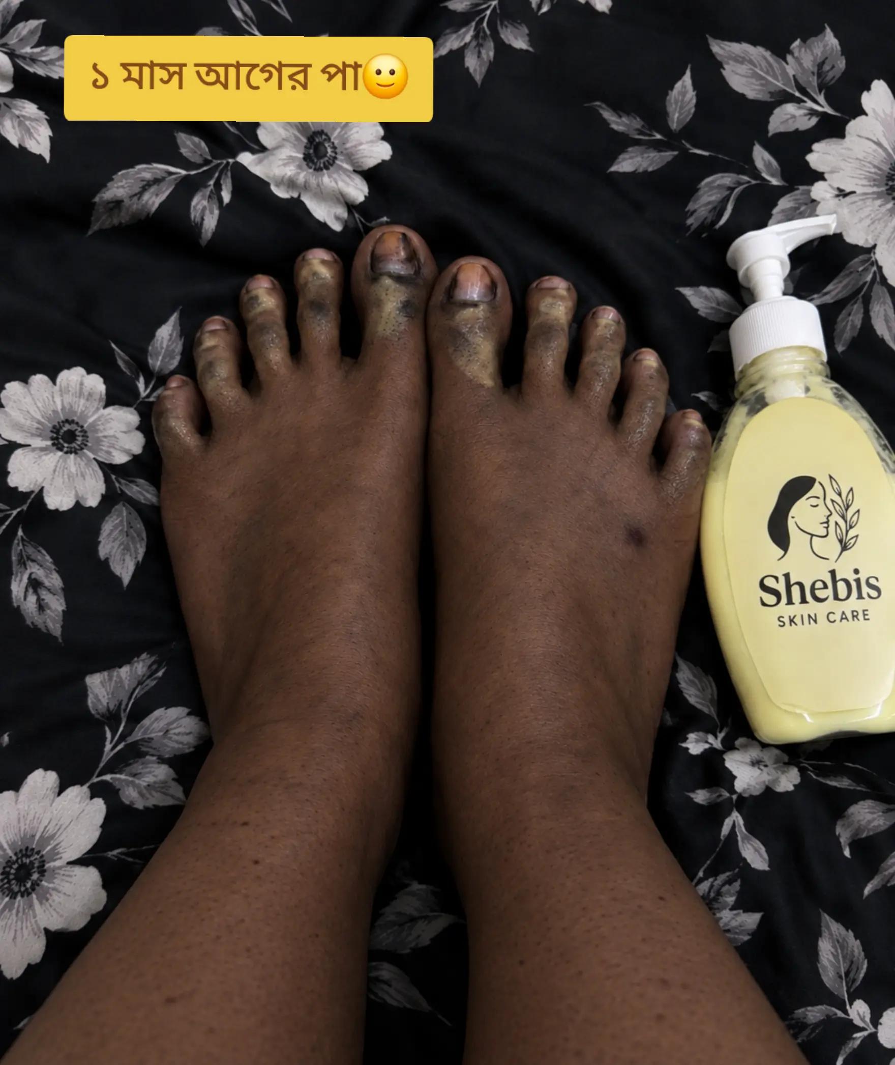 @Shebis skin care