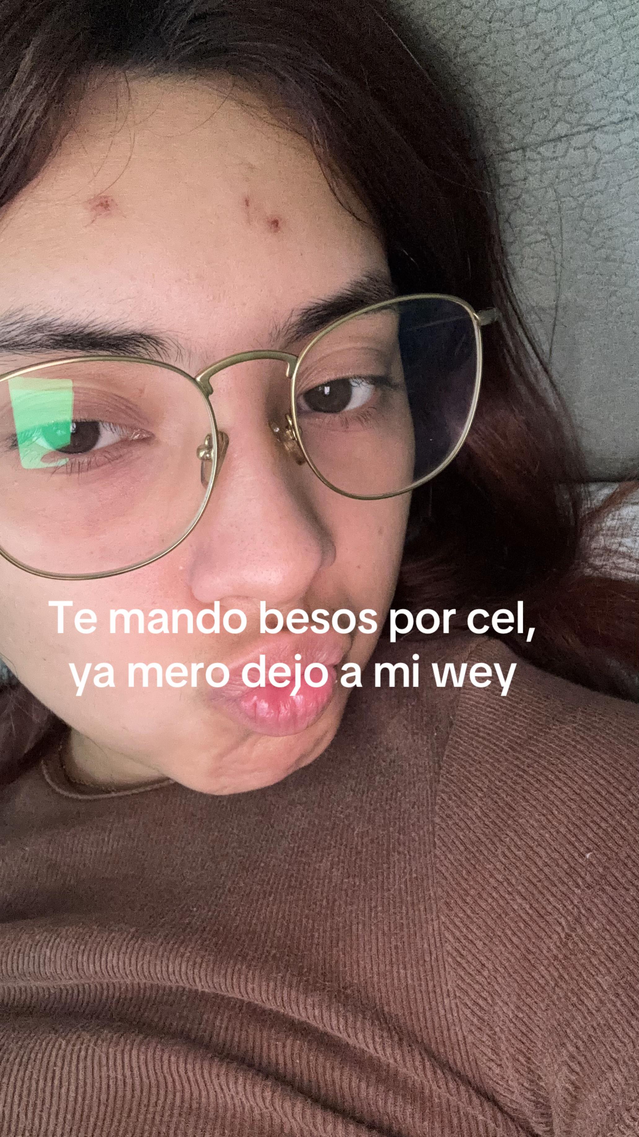@Sibelita