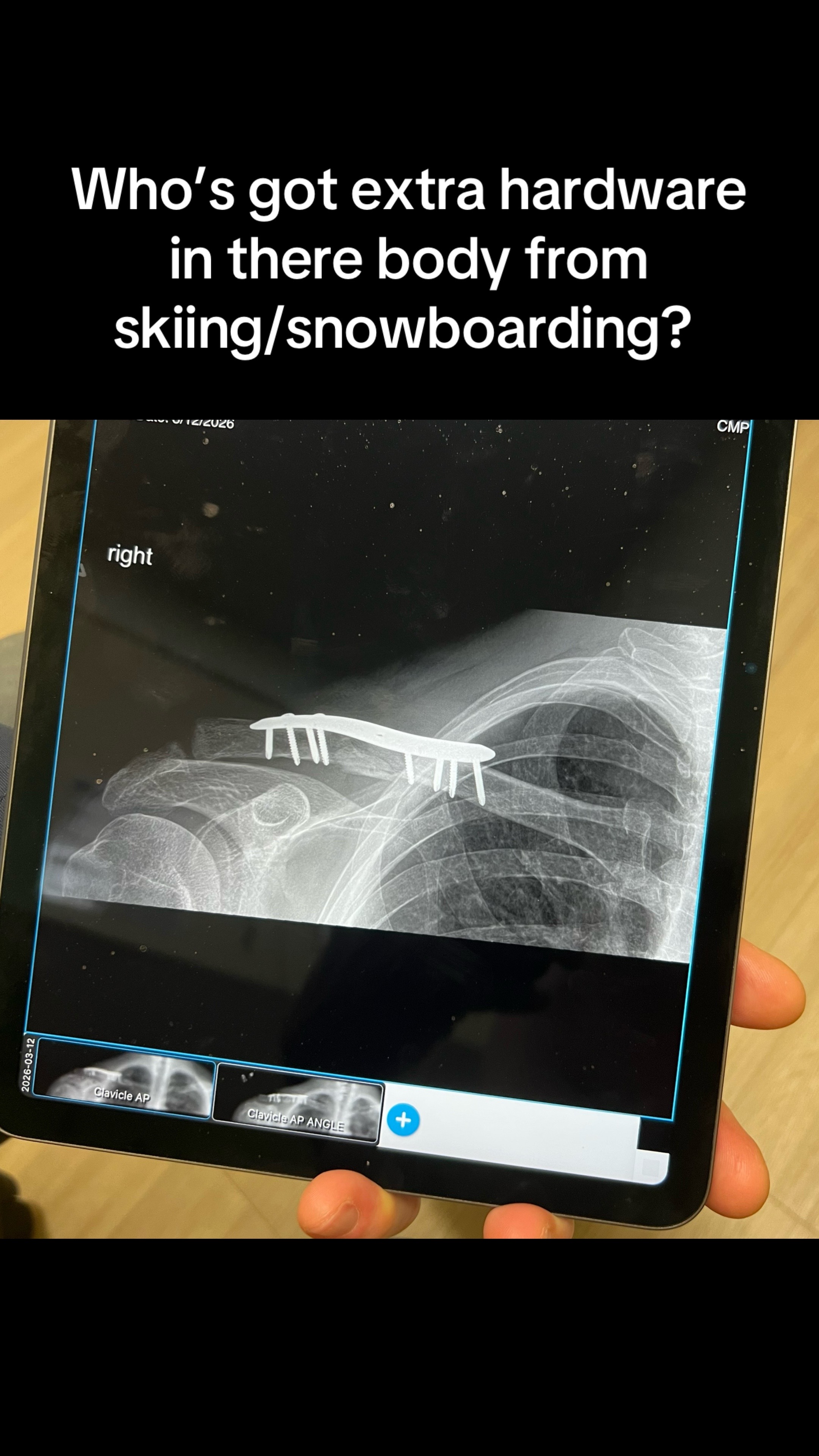 @skiingoutofnh