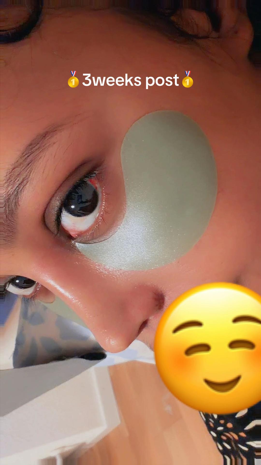 @rinoplasticatirana