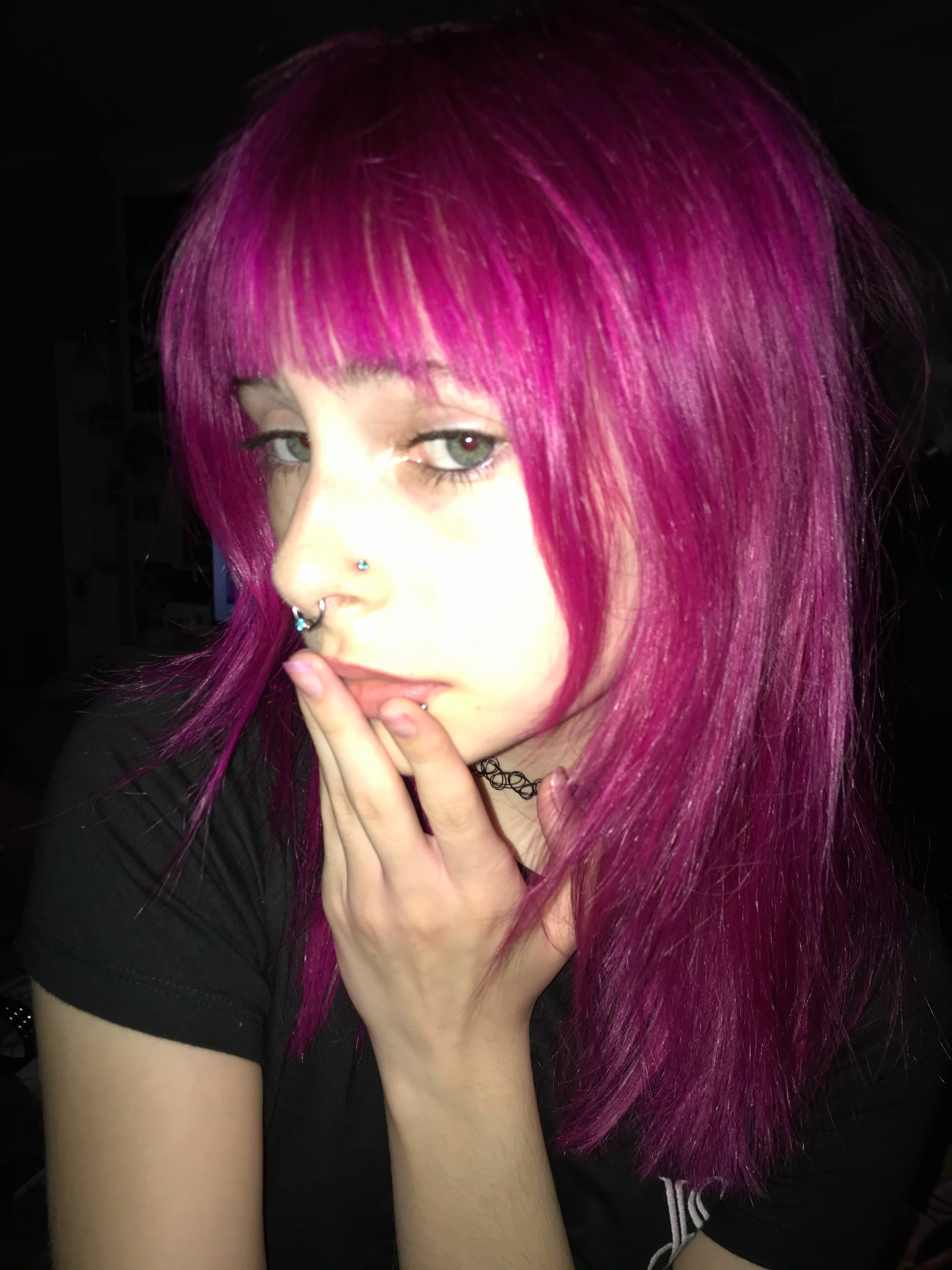 @diseasegirl3001