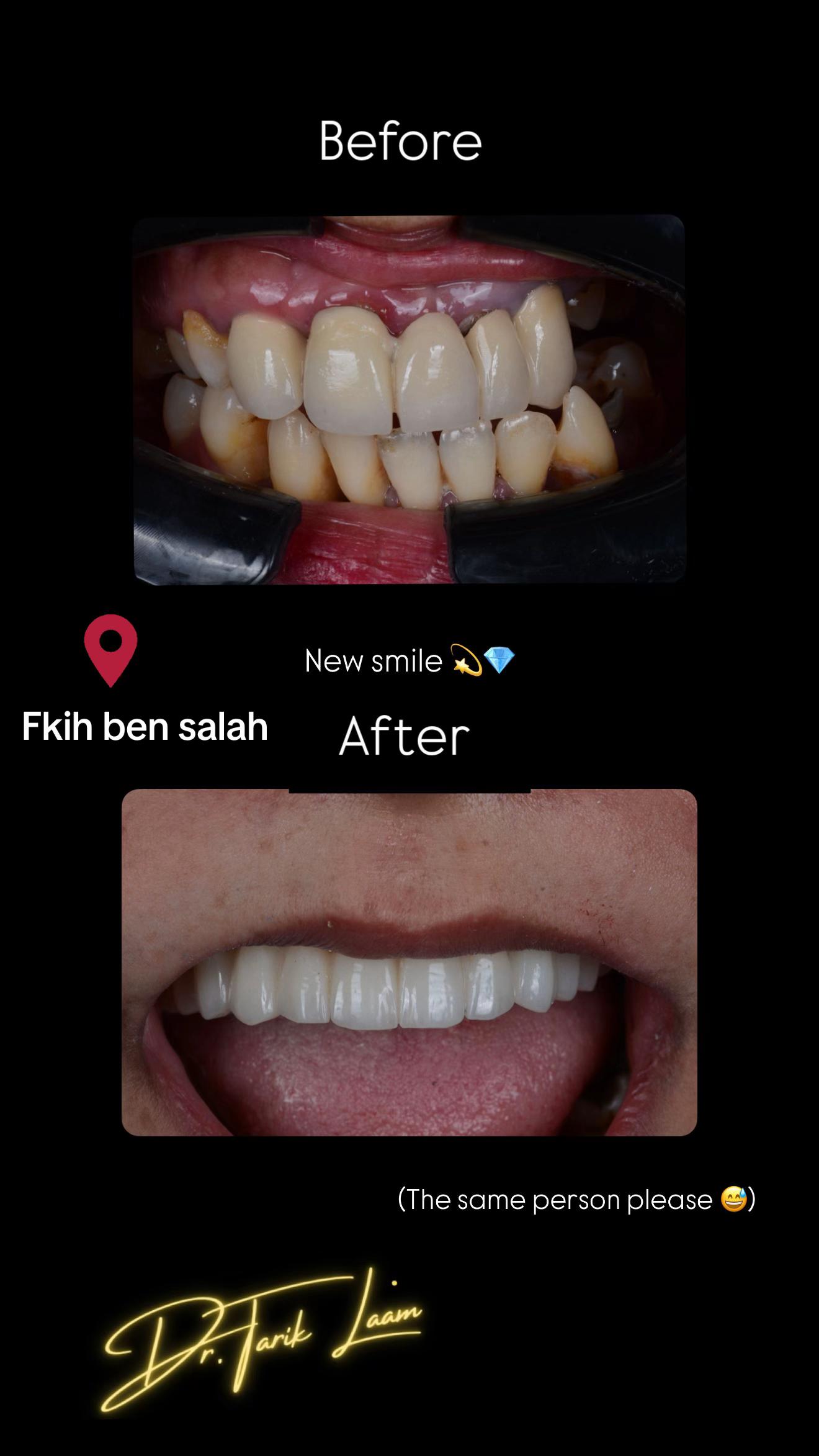 @Dr.tarik_laam