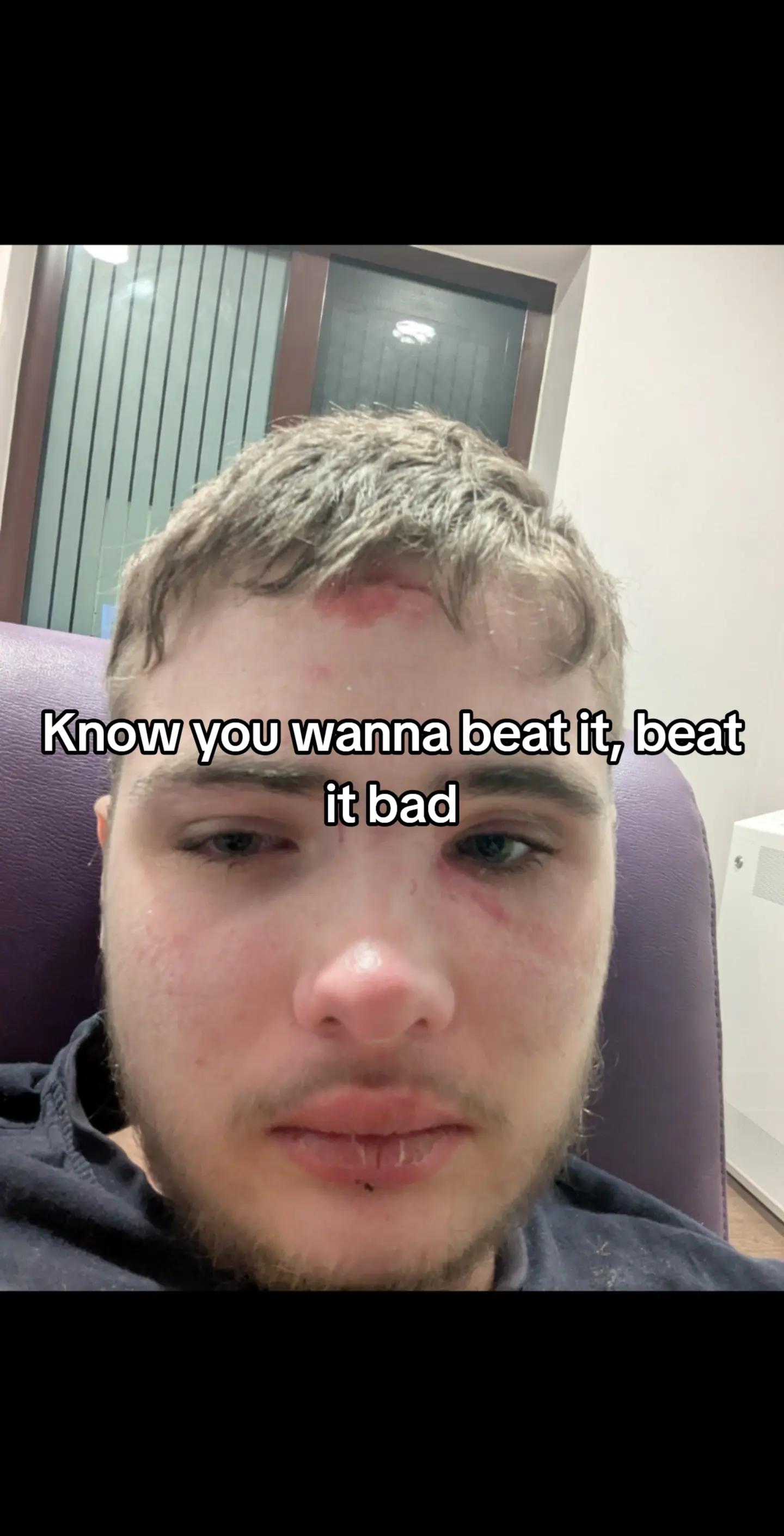 @Ryan