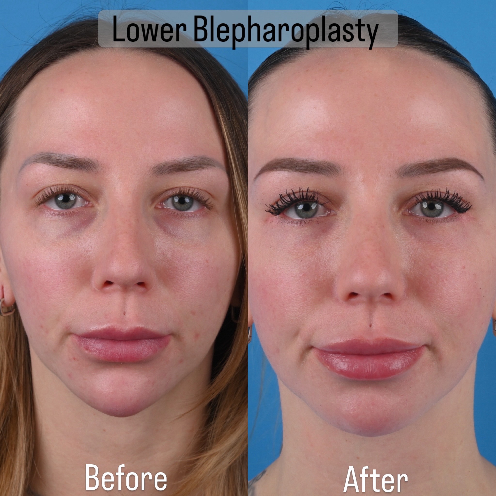 @Dr. Parit Patel, MD