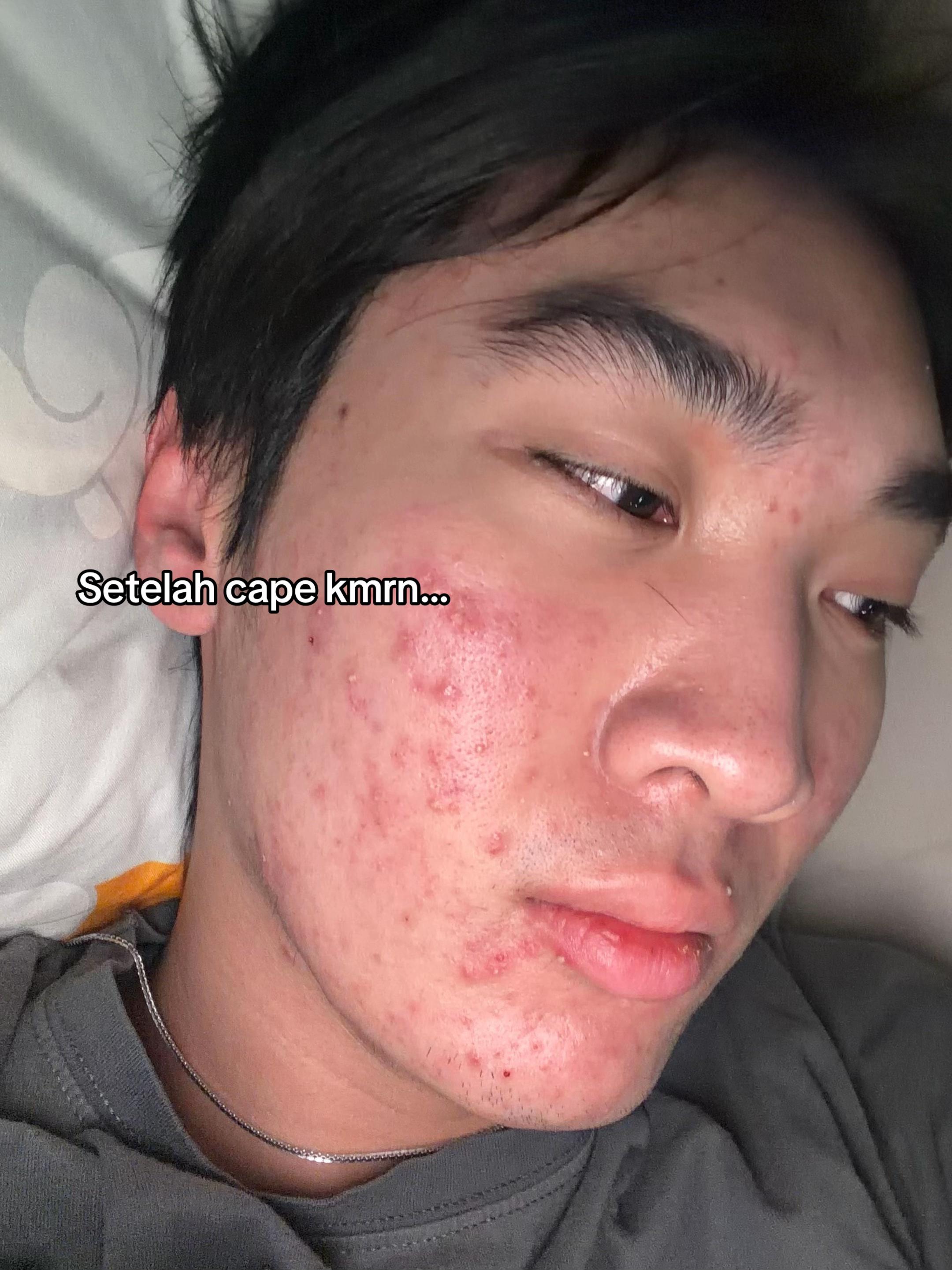 @Mau kulit sehat