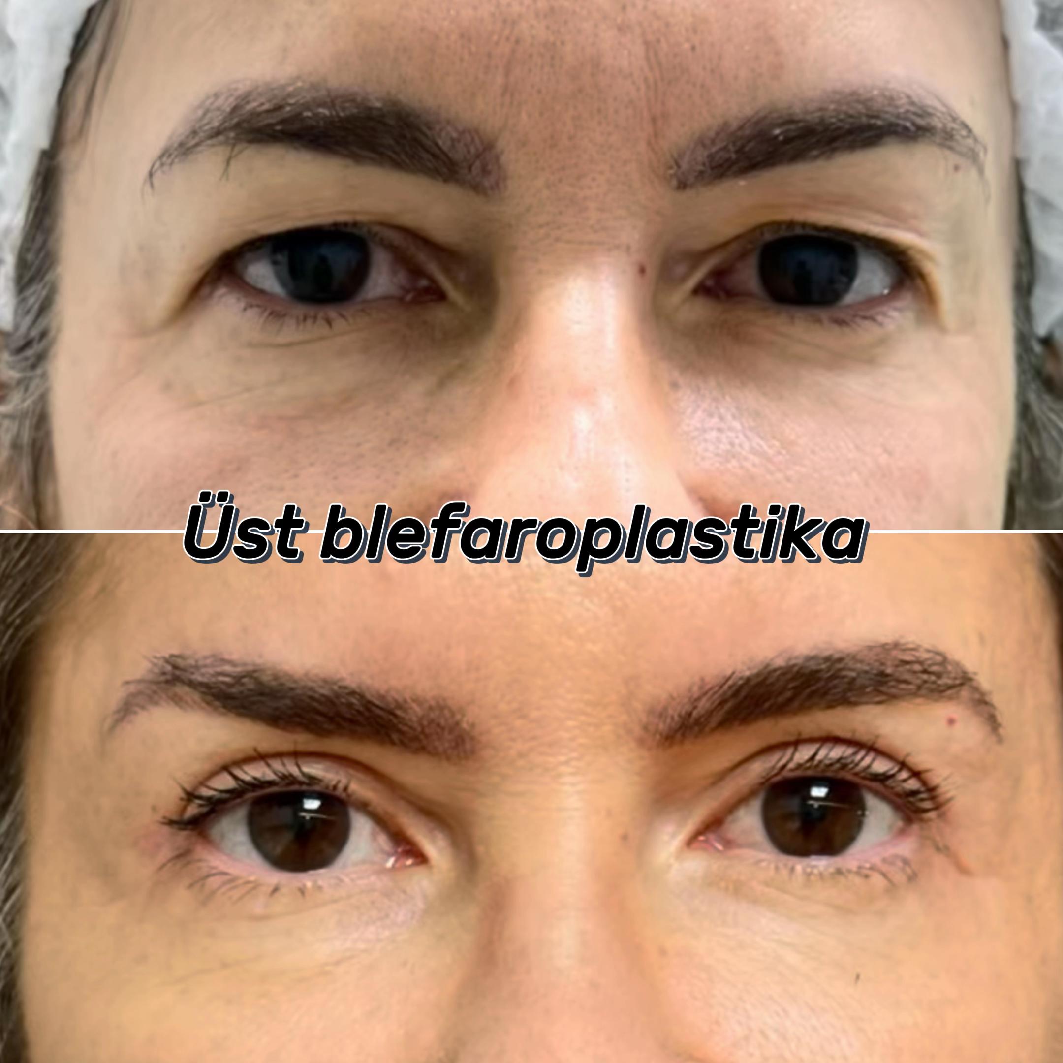 @Dr.ataxanli