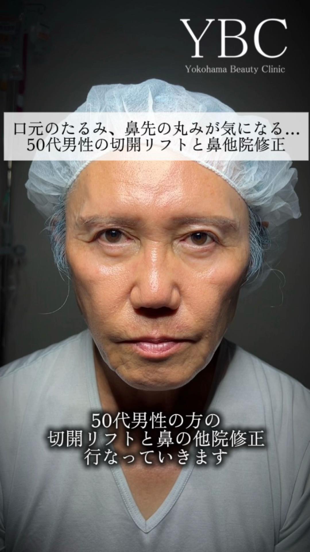 @イソセン/美容外科医（磯村亮輔院長）