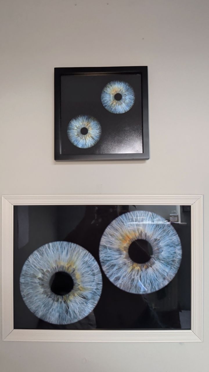 @Oliver | Aajonus' Iridology 👀