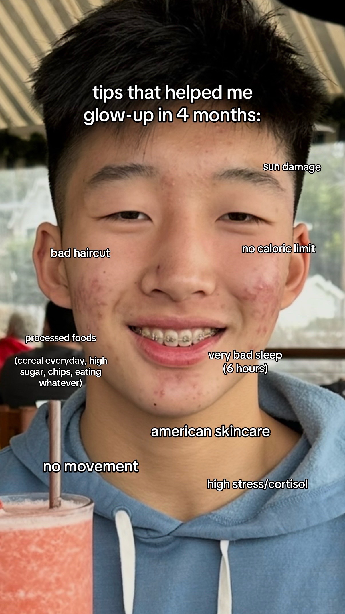 @JUSTIN