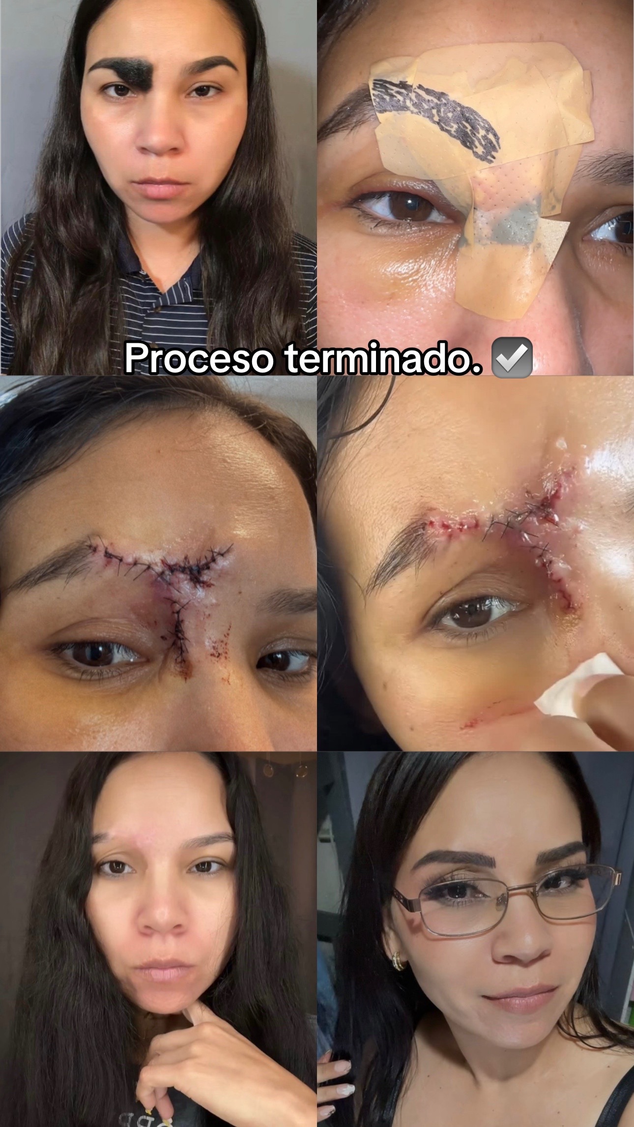 @️Angie Cast