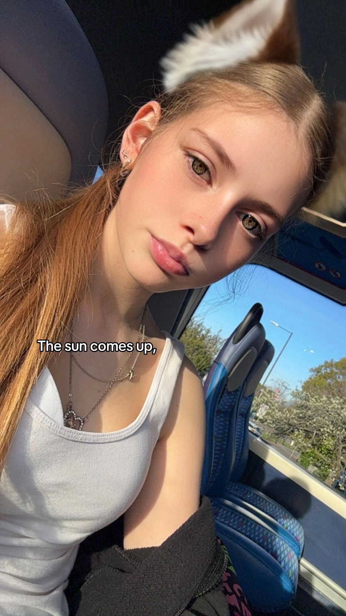 @Chloe