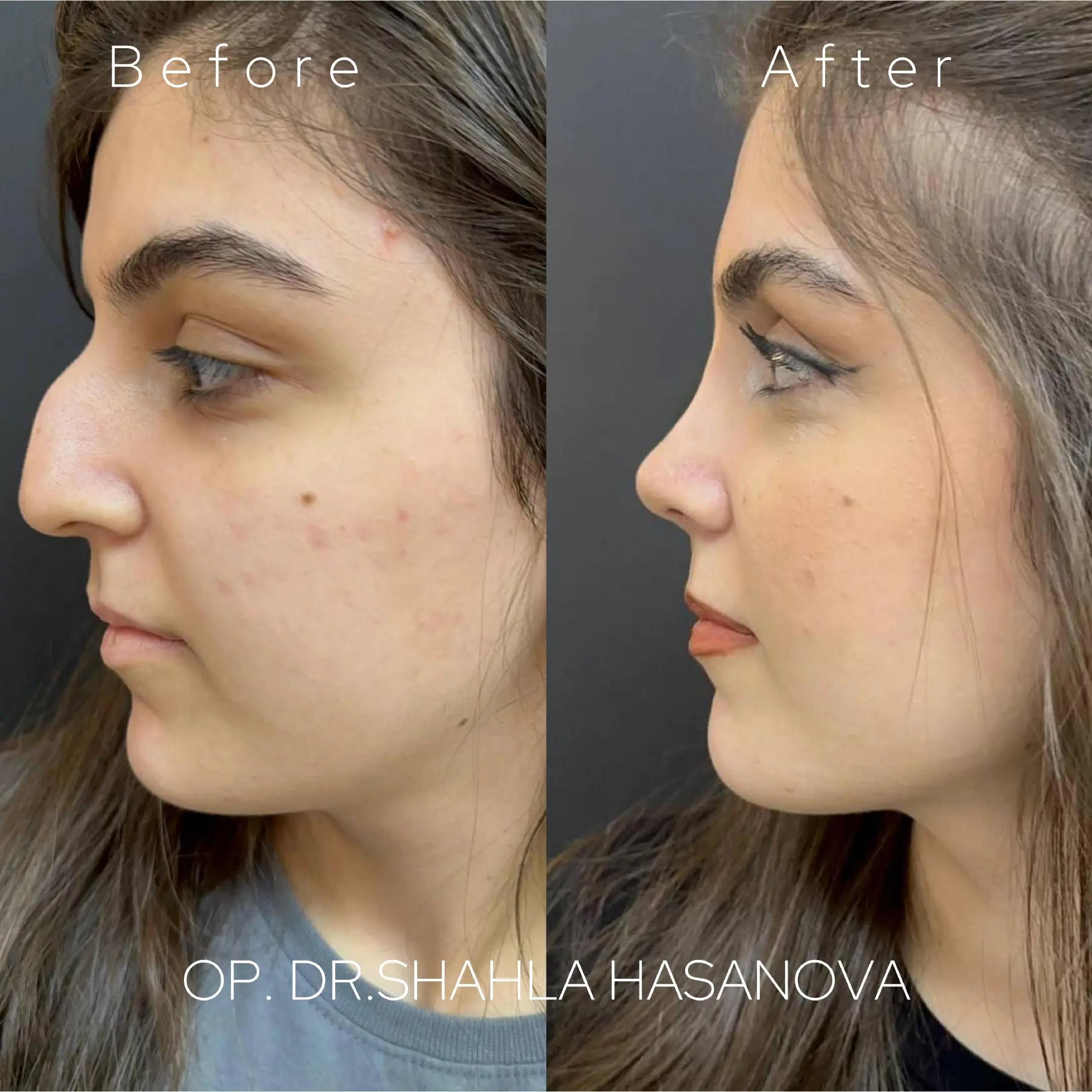 @Lor/Rinoloq/Dr. Şəhla Həsənova