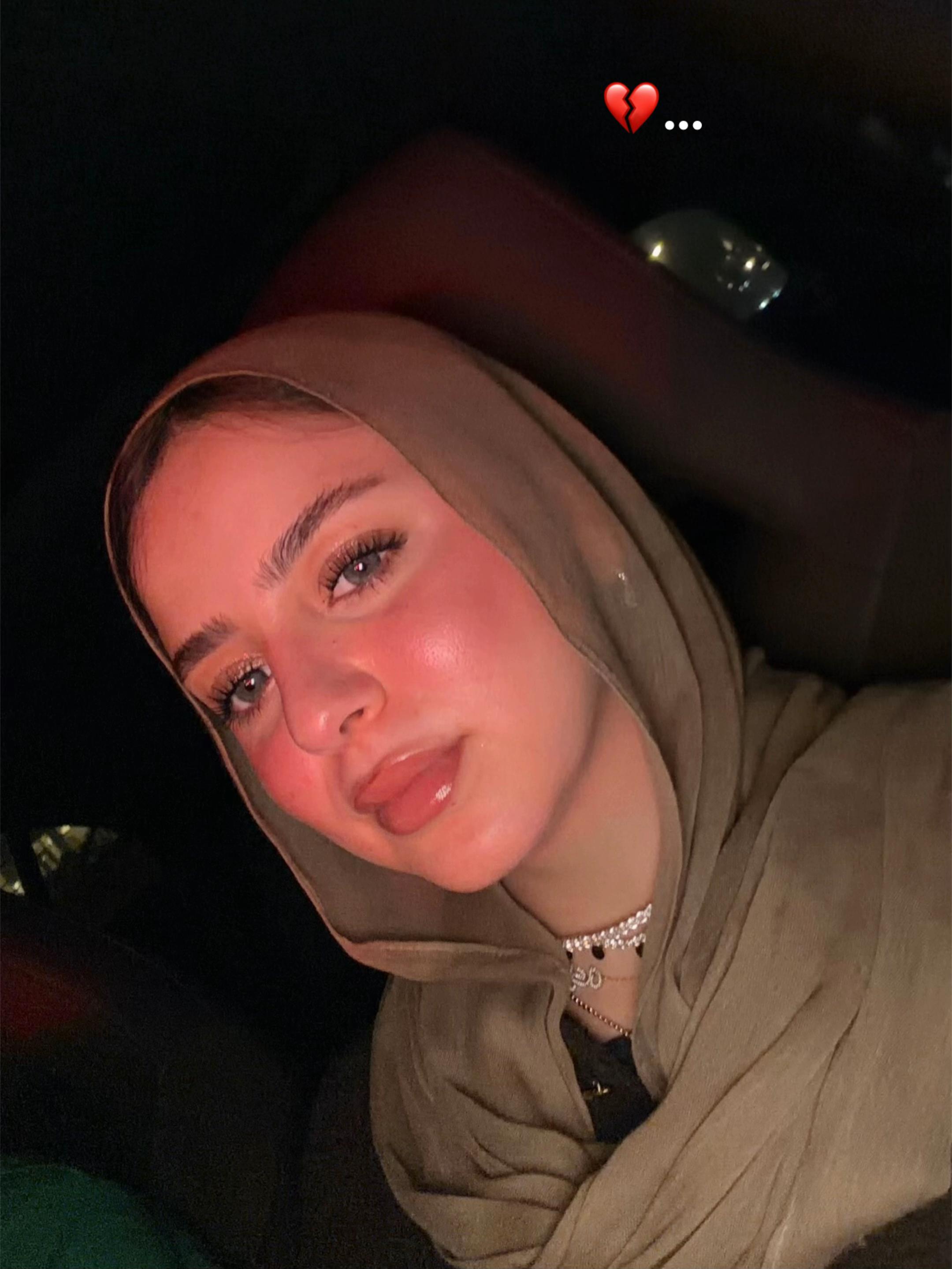 @Esraa Mohamed