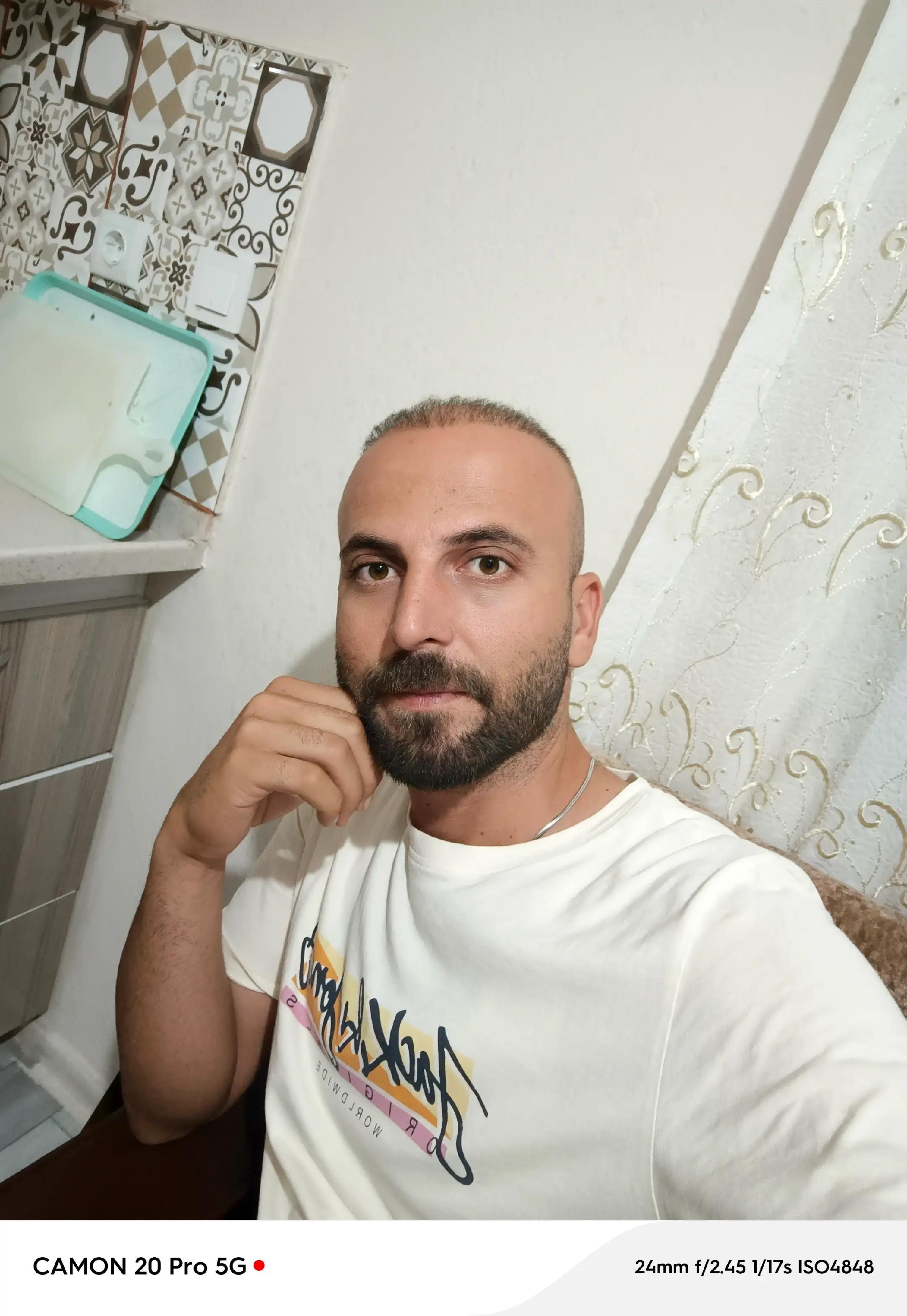 @Ahmetkpln3372