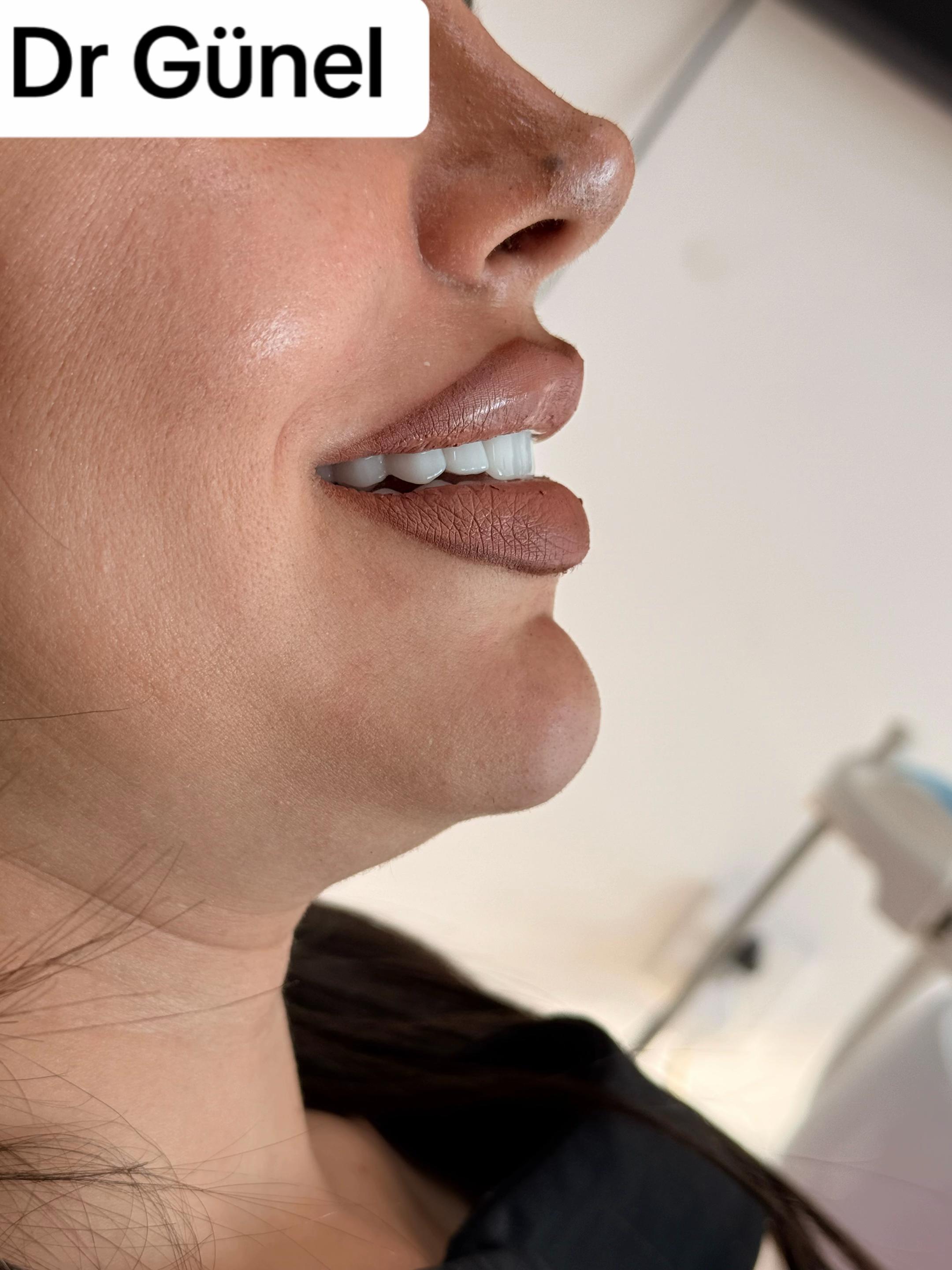 @Dentist_Günel