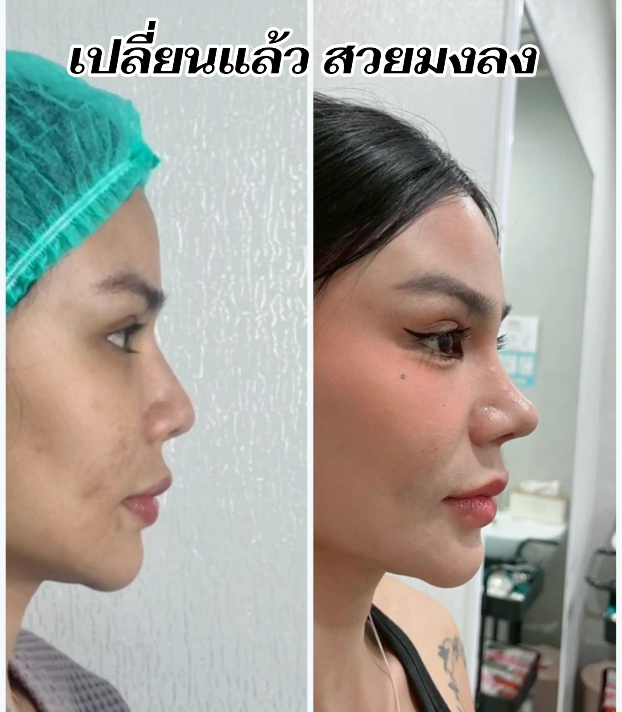 @หมอต๊ะ The V-Sage Clinic