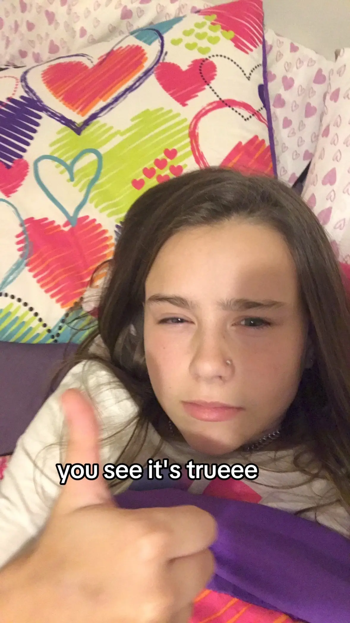 @vert