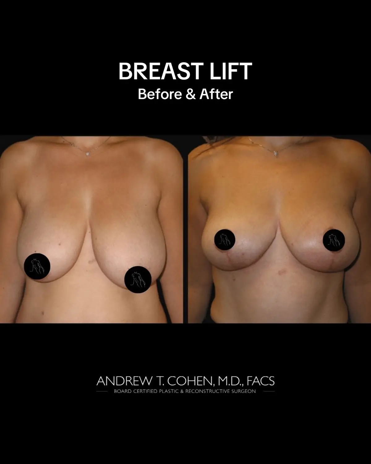 @Cohen MD Plastic Surgery