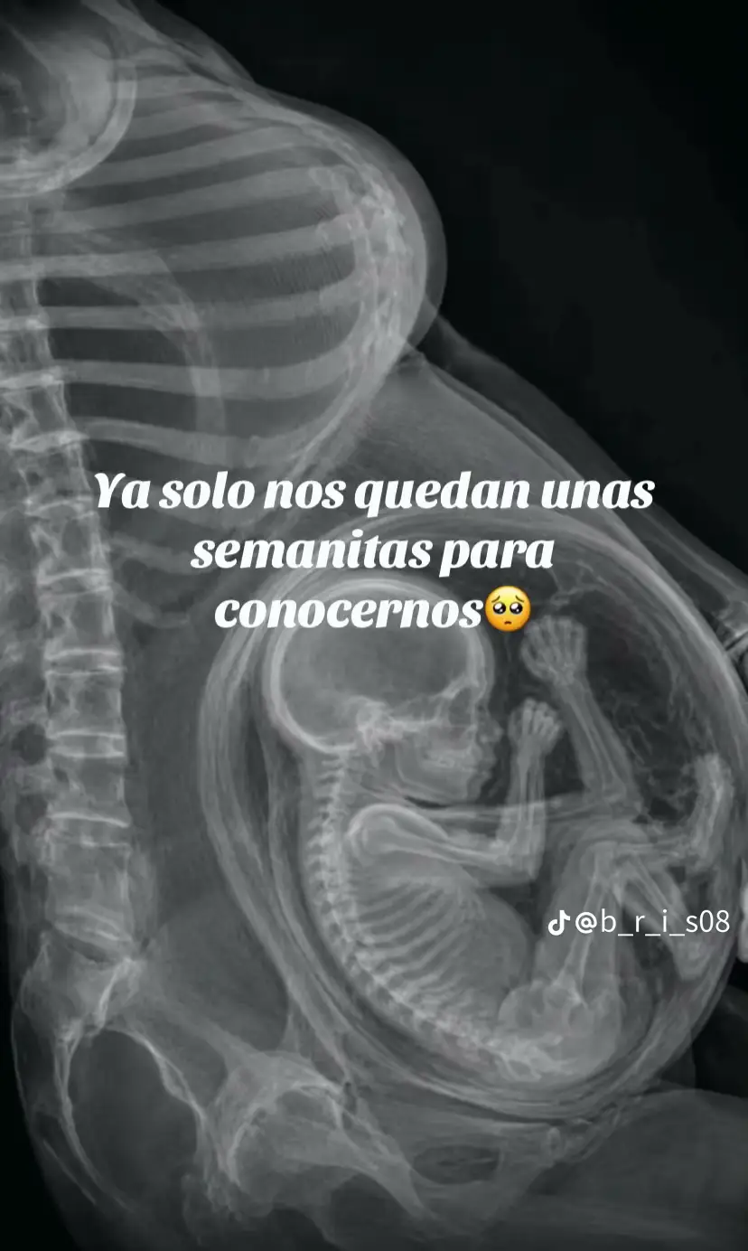 @Antho🧚♀️✨🌻🇲🇽