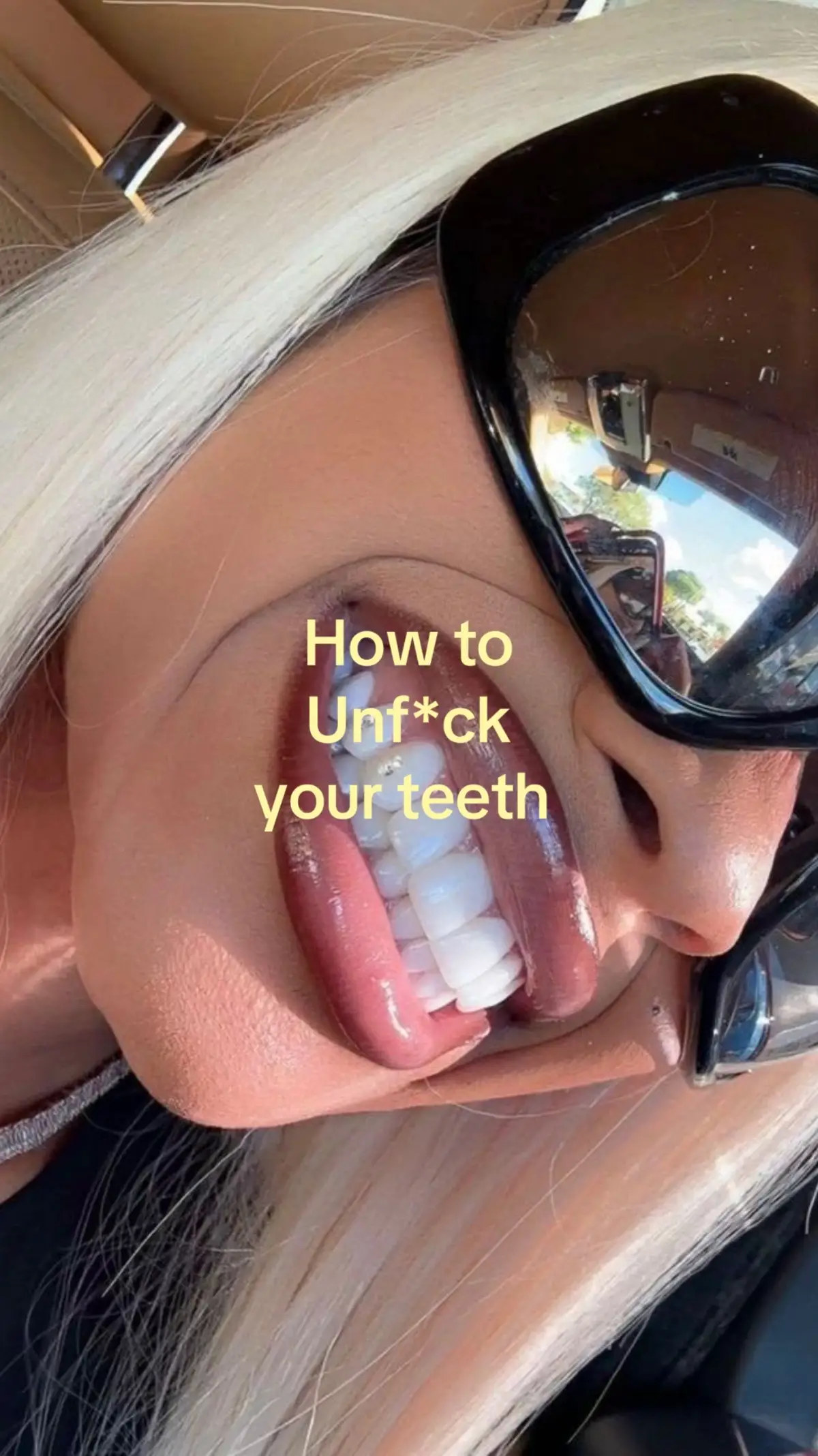 @Profits