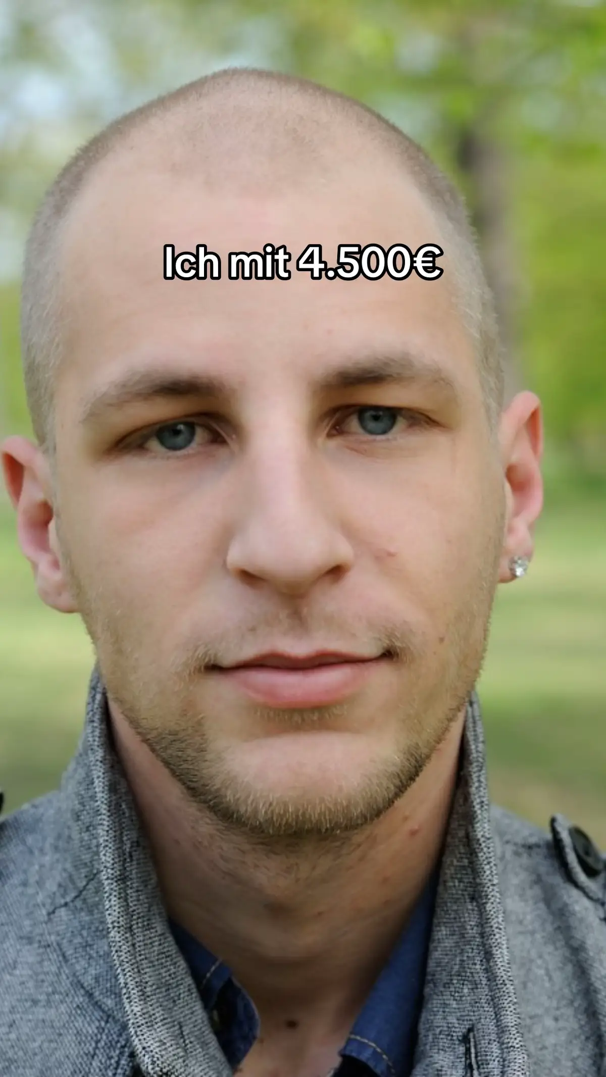 @Mr. Hairtransplant
