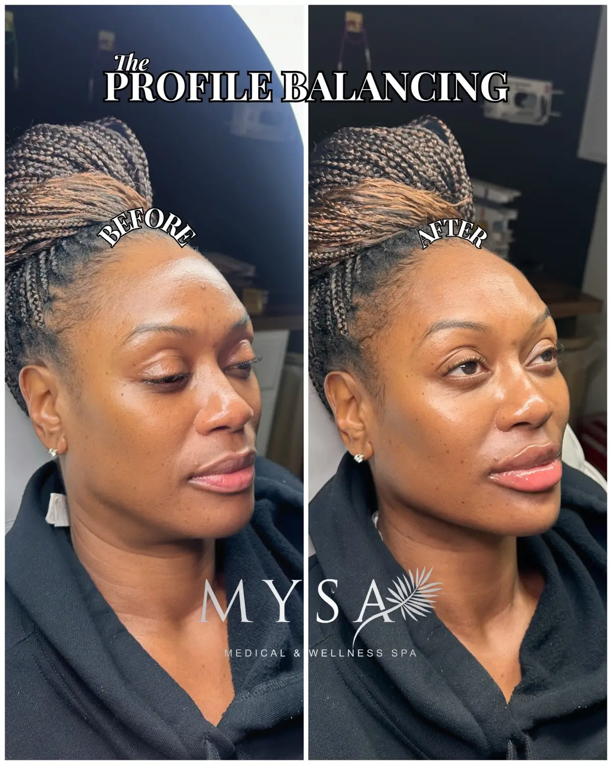 @Mysa Medical & Wellness Spa