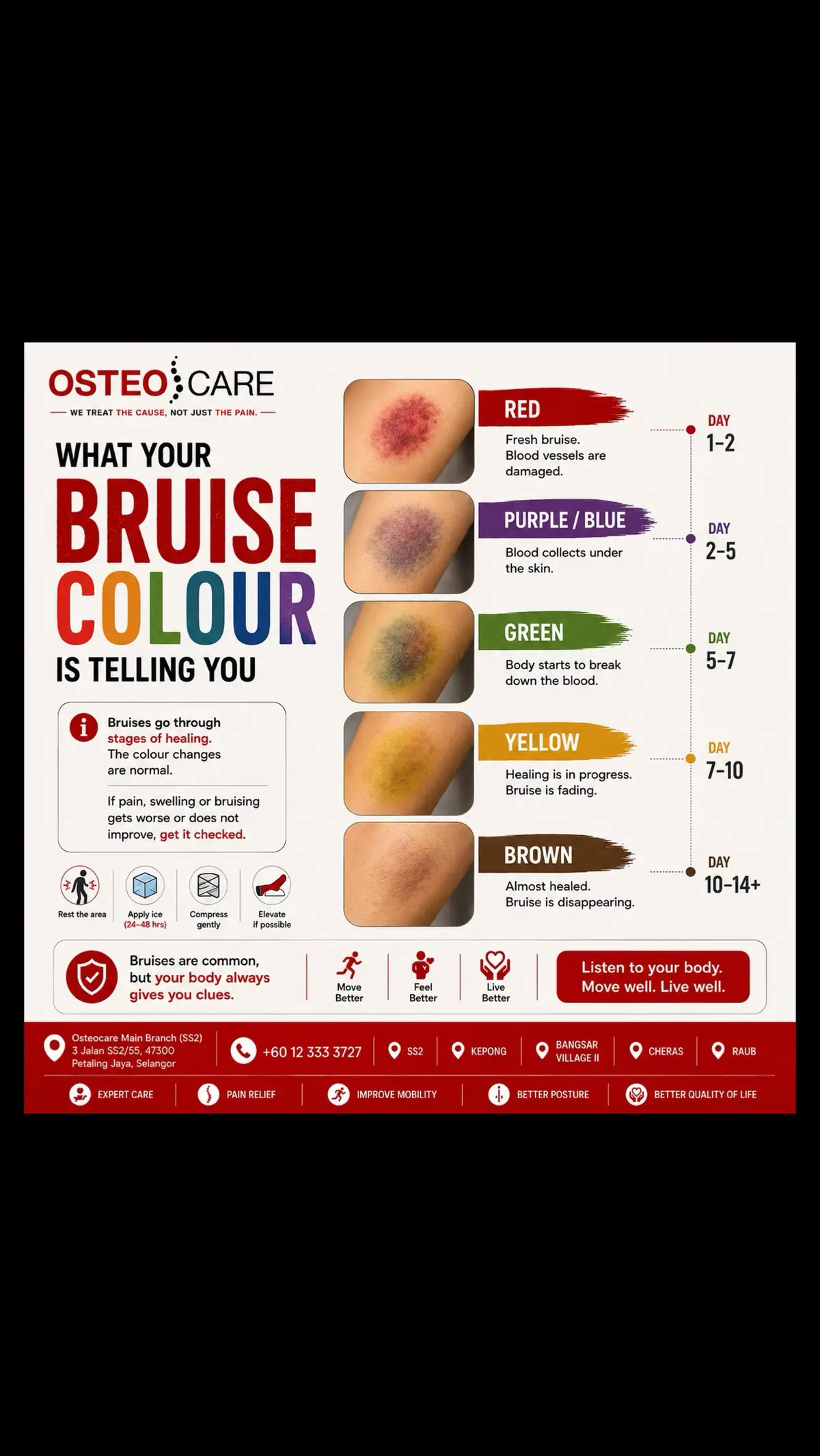 @Osteocare Bone Setting