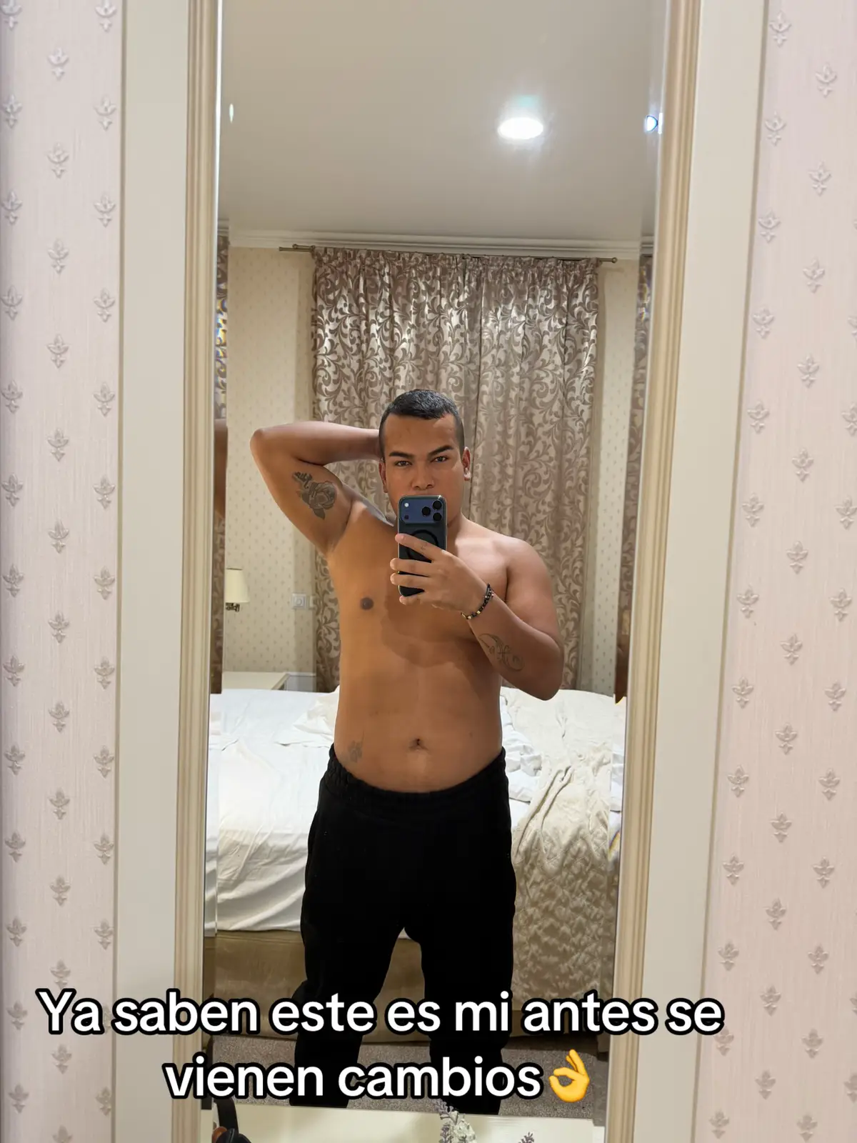 @Audel Rojas🇺🇦Mil Amores🇨🇴