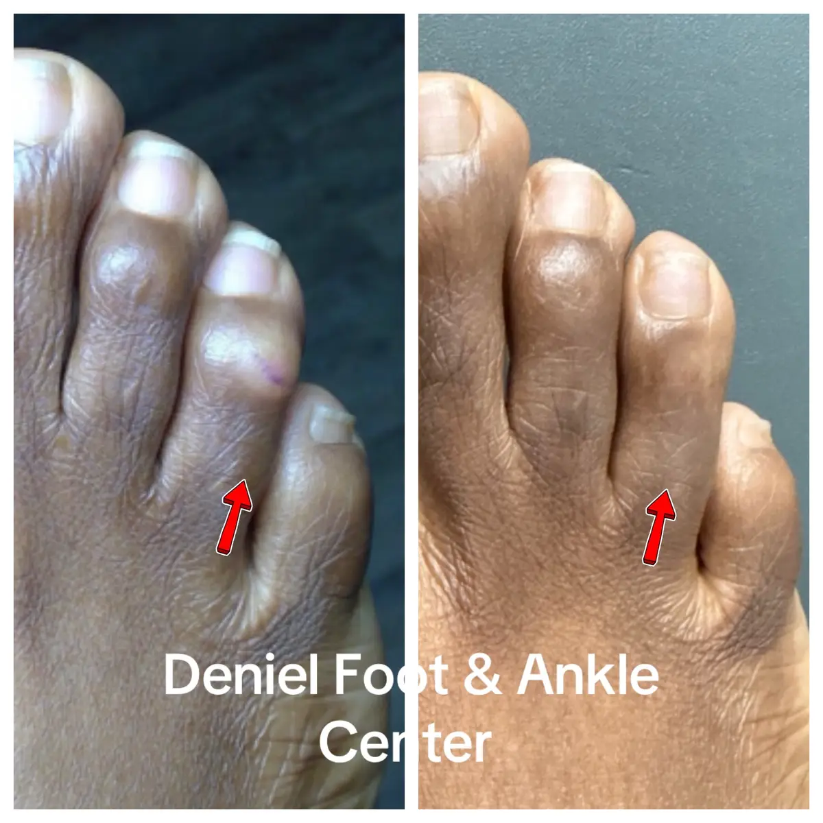 @Deniel Foot and Ankle Center