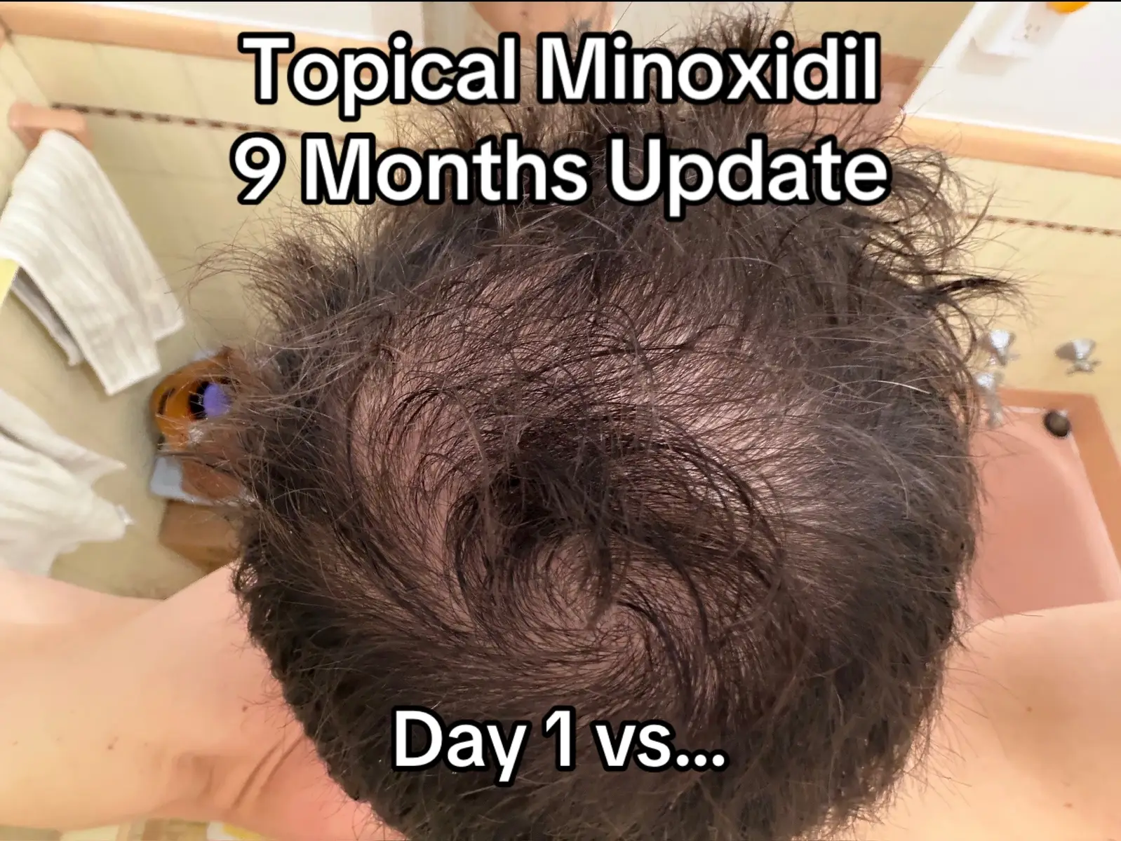 @scalp.hero