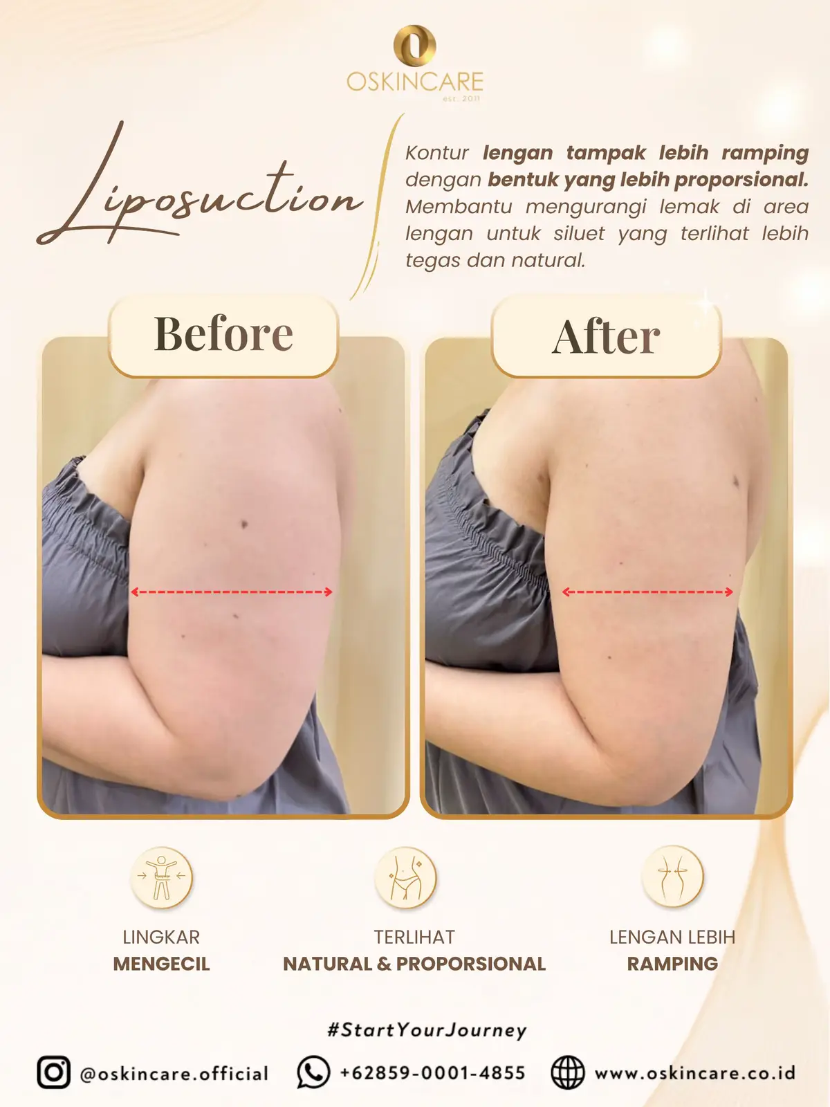 @oskincare.official