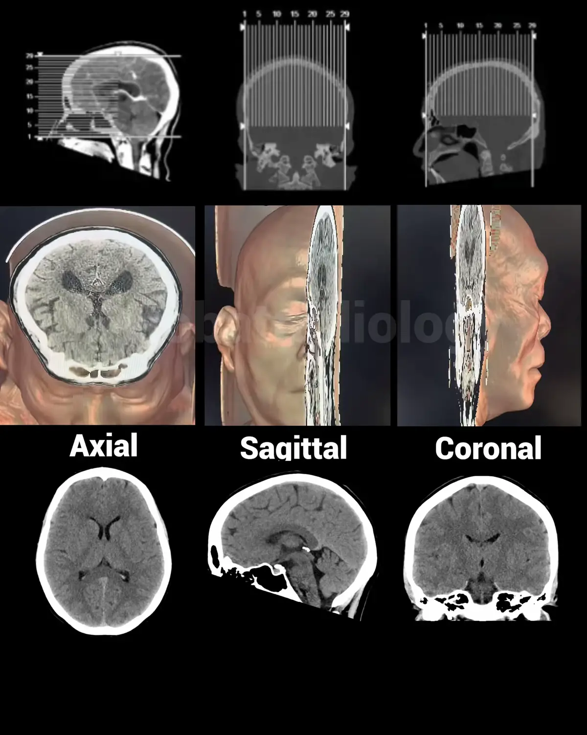 @Sobat Radiology