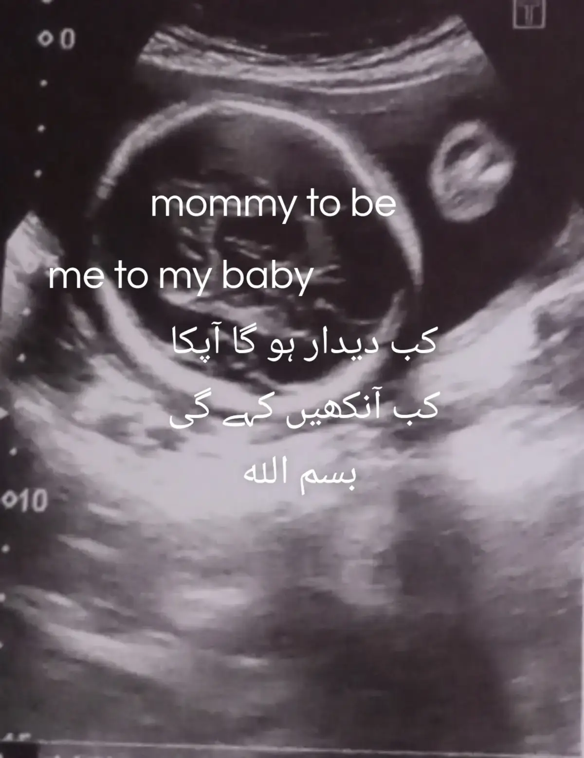 @Mommy to be