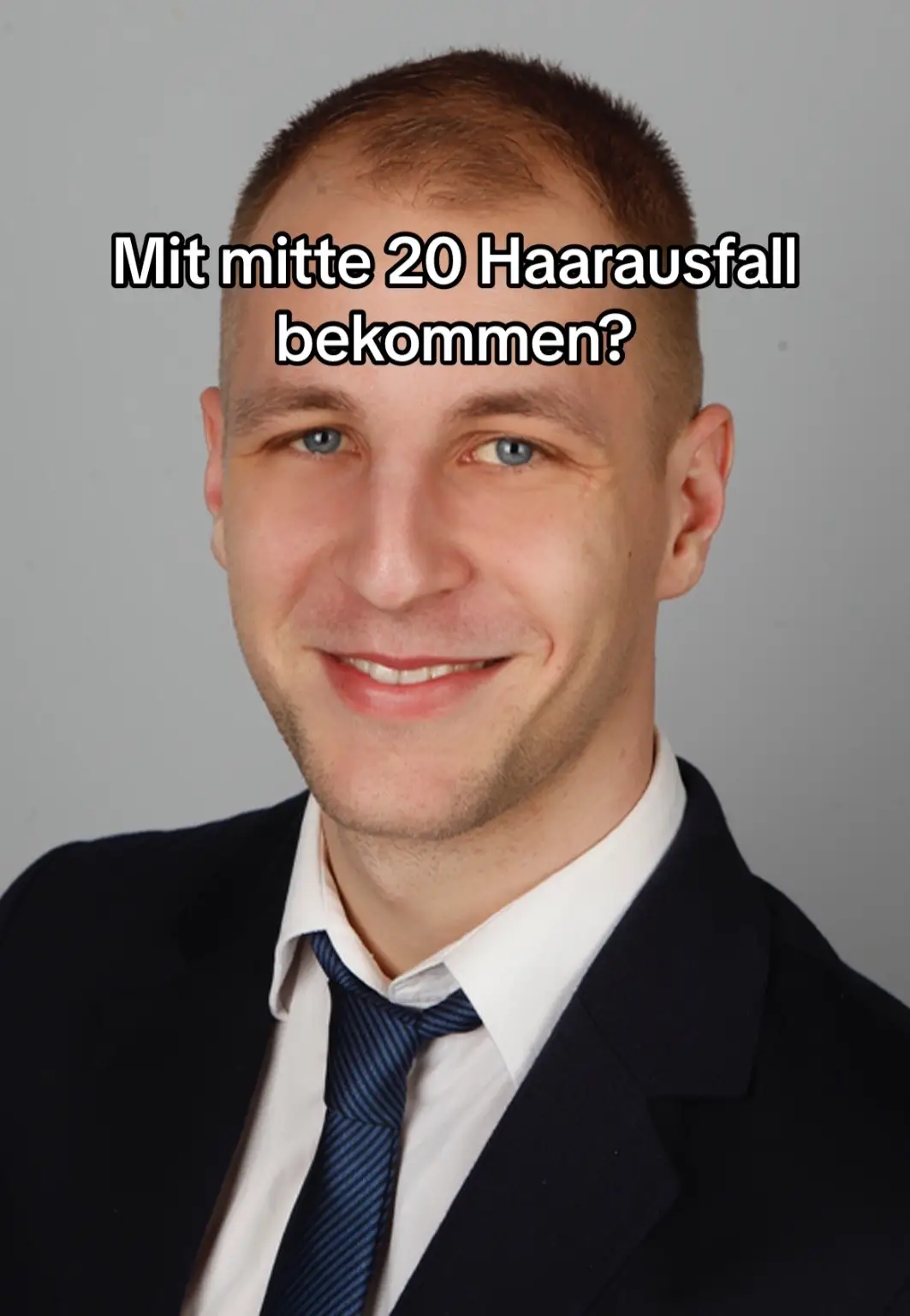 @Mr. Hairtransplant