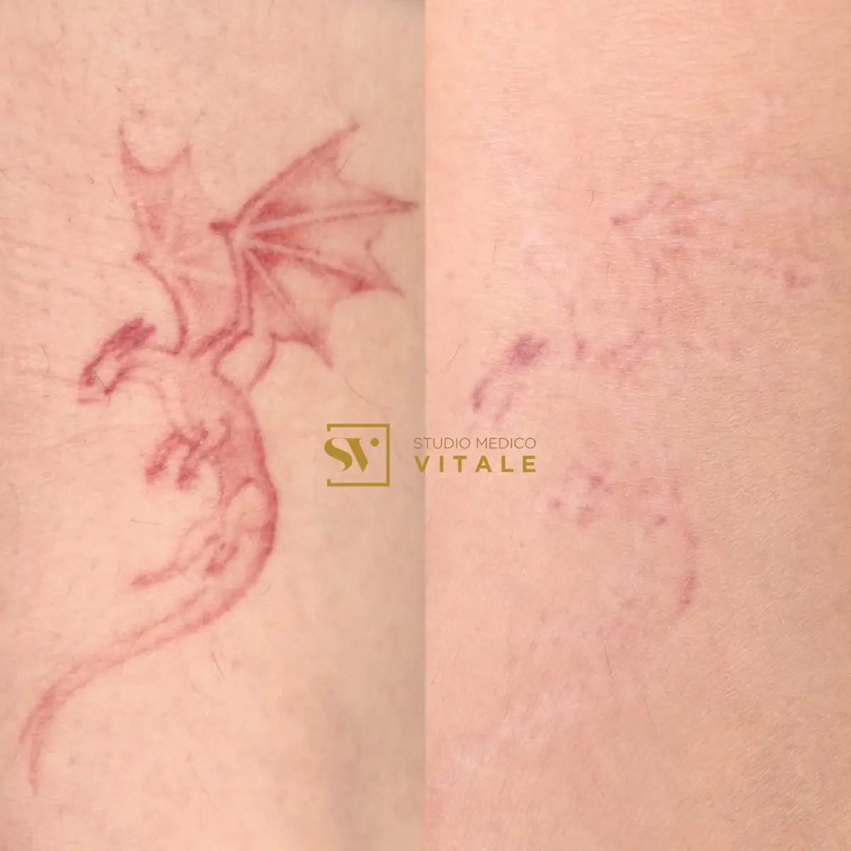 @Dr. Massimo Vitale