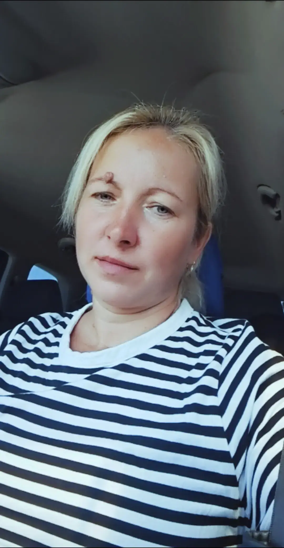@Alina